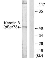 Cytokeratin 8 (phospho Ser73) Polyclonal Antibody