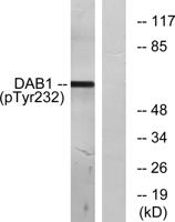 Dab1 (phospho Tyr232) Polyclonal Antibody