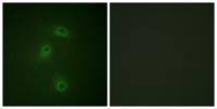 DAPK2 (phospho Ser318) Polyclonal Antibody