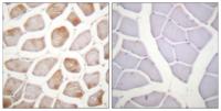 DAPK2 (phospho Ser318) Polyclonal Antibody
