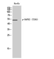 DAPK3 (phospho Thr265) Polyclonal Antibody