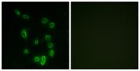 DARPP-32 (phospho Thr34) Polyclonal Antibody