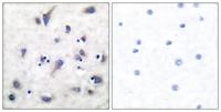 DARPP-32 (phospho Thr34) Polyclonal Antibody