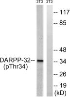 DARPP-32 (phospho Thr34) Polyclonal Antibody