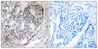 DARPP-32 (phospho Thr75) Polyclonal Antibody