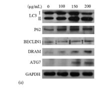 AMPKα1/2 (phospho Thr183/172) Polyclonal Antibody