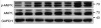 AMPKα1/2 (phospho Thr183/172) Polyclonal Antibody