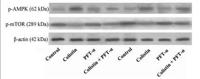 AMPKα1/2 (phospho Thr183/172) Polyclonal Antibody