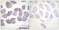 AMPKβ1 (phospho Ser182) Polyclonal Antibody
