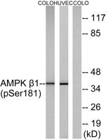AMPKβ1 (phospho Ser182) Polyclonal Antibody