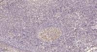 AMPKβ1 (phospho Ser182) Polyclonal Antibody