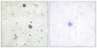 Amyloid-β (phospho Thr743) Polyclonal Antibody