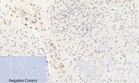 AP-1 (phospho Ser63) Polyclonal Antibody