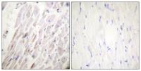 Dematin (phospho Ser403) Polyclonal Antibody
