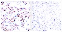 AP-1 (phospho Thr91) Polyclonal Antibody