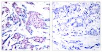 AP-1 (phospho Thr93) Polyclonal Antibody