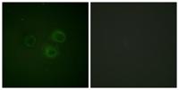 DNAM-1 (phospho Ser329) Polyclonal Antibody