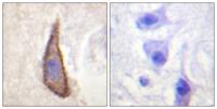 DNAM-1 (phospho Ser329) Polyclonal Antibody