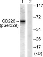 DNAM-1 (phospho Ser329) Polyclonal Antibody