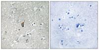 APC1 (phospho Ser355) Polyclonal Antibody