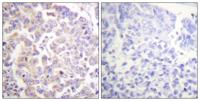 APC1 (phospho Ser688) Polyclonal Antibody