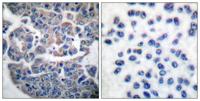 eEF2K (phospho Ser366) Polyclonal Antibody