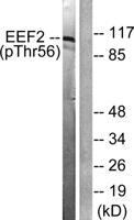 EF-2 (phospho Thr56) Polyclonal Antibody