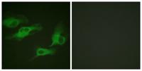 AR-β2 (phospho Ser346) Polyclonal Antibody