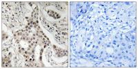GRIP-1 (phospho Ser736) Polyclonal Antibody