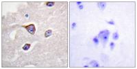 GRK 1 (phospho Ser21) Polyclonal Antibody