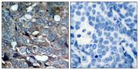 ASK 1 (phospho Ser83) Polyclonal Antibody