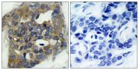 ASK 1 (phospho Ser966) Polyclonal Antibody