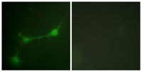 Ataxin-1 (phospho Ser776) Polyclonal Antibody