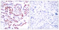 ATF-2 (phospho Ser112) Polyclonal Antibody
