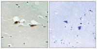 ATF-2 (phospho Ser472) Polyclonal Antibody