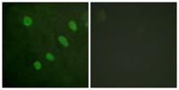 ATF-2 (phospho Ser480) Polyclonal Antibody