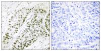ATF-2 (phospho Ser480) Polyclonal Antibody
