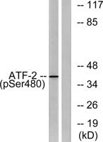 ATF-2 (phospho Ser480) Polyclonal Antibody