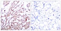 ATF-2 (phospho Thr73) Polyclonal Antibody