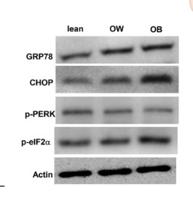 eIF2α (phospho Ser51) Polyclonal Antibody