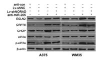 eIF2α (phospho Ser51) Polyclonal Antibody