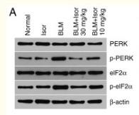 eIF2α (phospho Ser51) Polyclonal Antibody