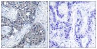 eIF4E (phospho Ser209) Polyclonal Antibody