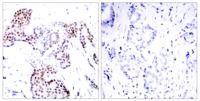 Elk-1 (phospho Ser389) Polyclonal Antibody