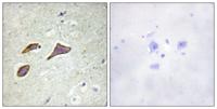 ENaC β (phospho Thr615) Polyclonal Antibody