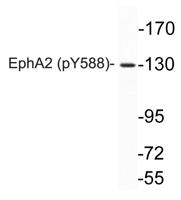 EphA2 (phospho Tyr588) Polyclonal Antibody