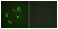 EphA2/3/4 (phospho Tyr588/596) Polyclonal Antibody