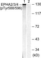 EphA2/3/4 (phospho Tyr588/596) Polyclonal Antibody
