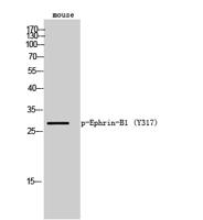 Ephrin-B1 (phospho Tyr317) Polyclonal Antibody