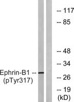 Ephrin-B1 (phospho Tyr317) Polyclonal Antibody